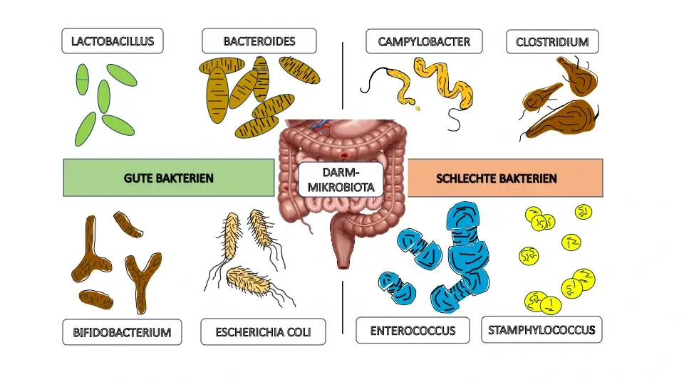 Infografik zur Darmmikrobiota bei Reizdarmsyndrom: Darstellung des Gleichgewichts zwischen guten und schlechten Darmbakterien und der Wirkung von Probiotika.